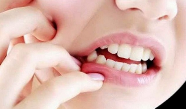 ilustrasi dokter gigi di karawang